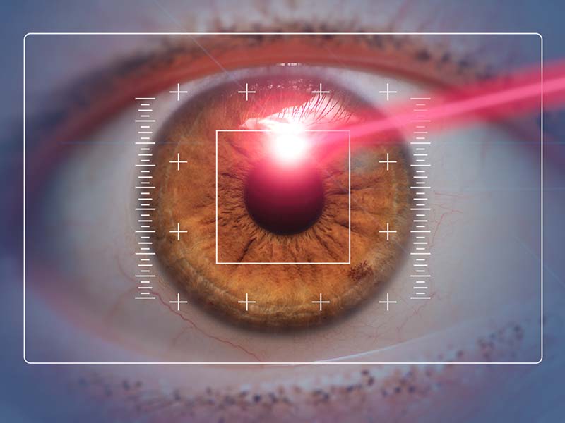 Laser Eye Surgery - Medlife Group